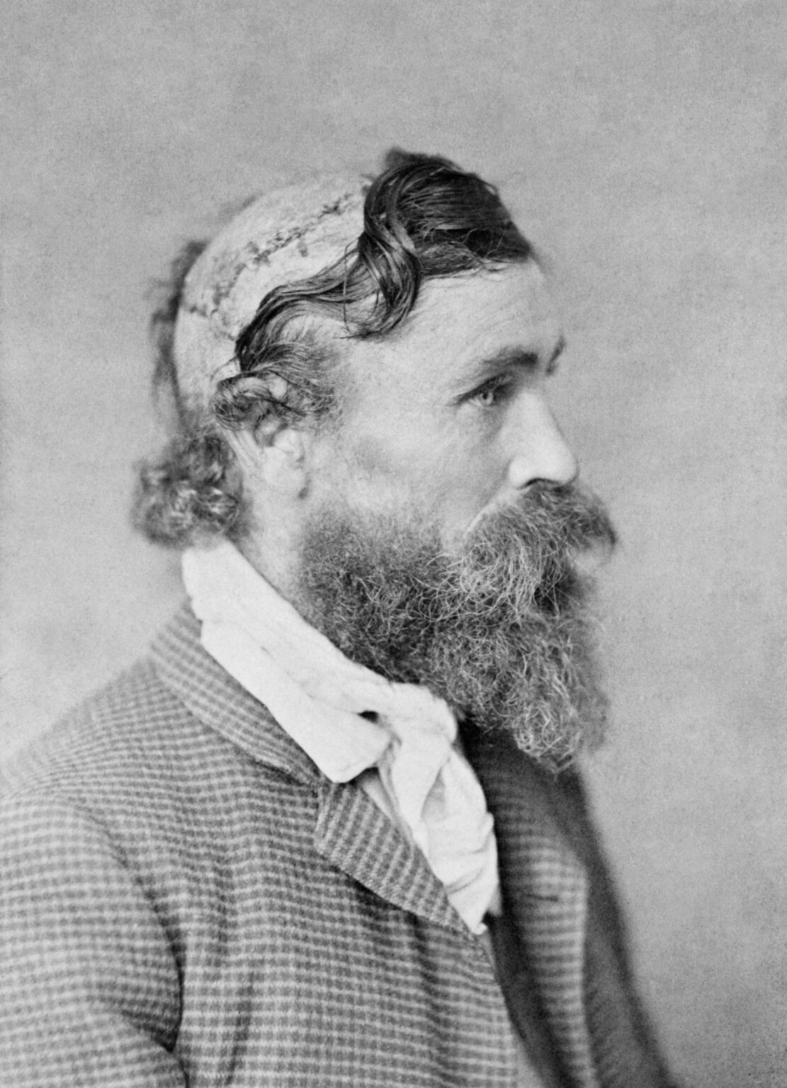 Robert McGee byl oskalpován siouxským náčelníkem Malou želvou, když mu bylo 14 let v roce 1864. Tato fotografie pochází z roku 1890.